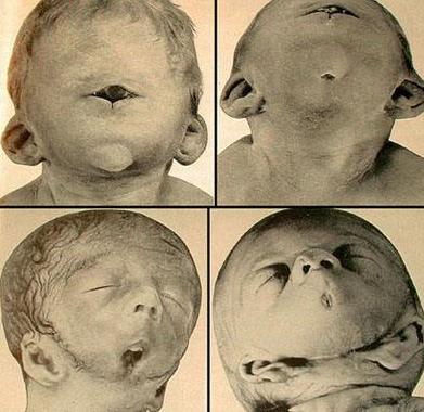 肉荒（6）：灾荒降临人性尽失，饲养克隆婴儿为食