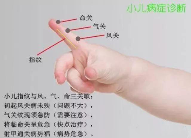 舌诊面诊手诊脉诊哪个简单好学,小儿手诊面诊口诀