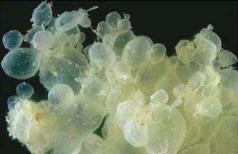 这些原因导致孕期出血！必须去医院