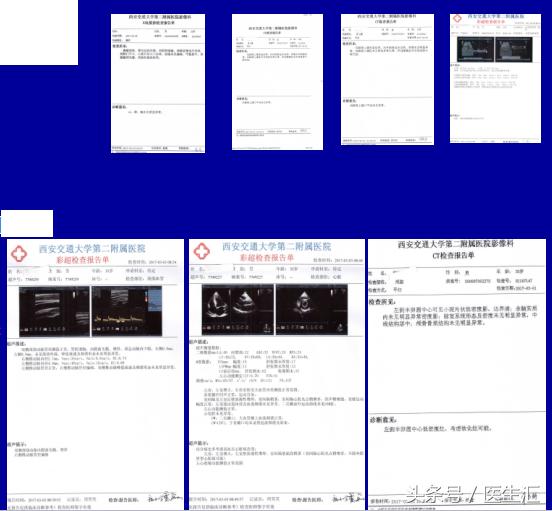 高血压一般超过多少才算高血压,35岁以上人群高血压发病率