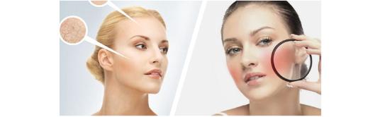 如何拯救油皮敏感肌,怎样拯救油性敏感皮肤