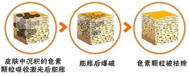 桃树褐斑穿孔病治疗方法,褐斑可以激光治疗吗