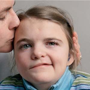 冷热交替吃东西补救办法,受凉嘴歪恢复期需要吃药吗