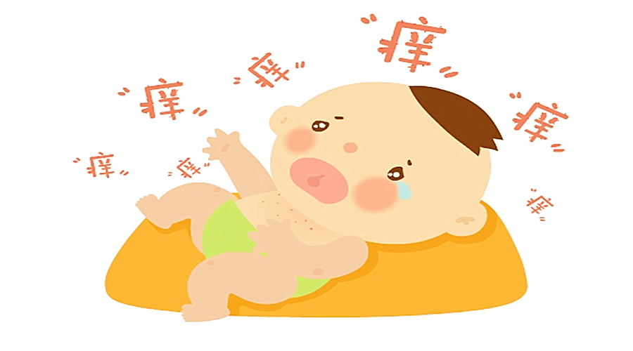 治蚊虫叮咬湿疹痱子什么药膏好用,婴儿蚊虫叮咬止痒痱子药膏第一名