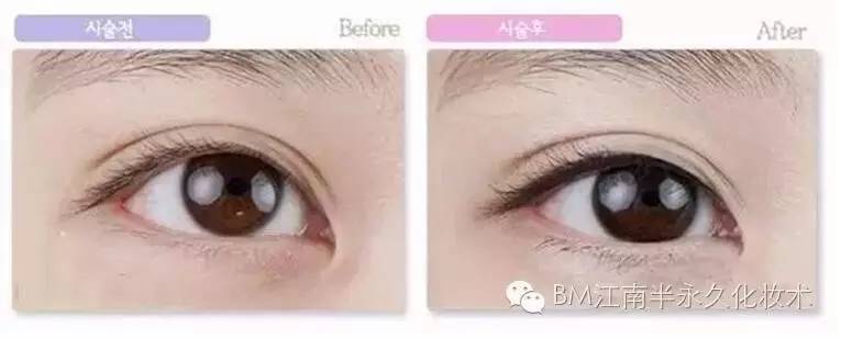 半永久现在都有什么,半永久跟永久