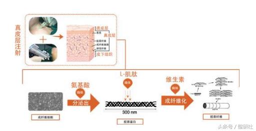 温顺谦和大妈修炼计——扼制颈部老化