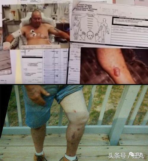 被闪电击中的人会怎么样,被闪电击中得到永生