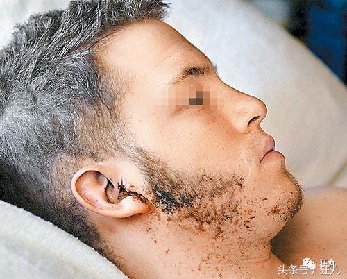 被闪电击中的人会怎么样,被闪电击中得到永生