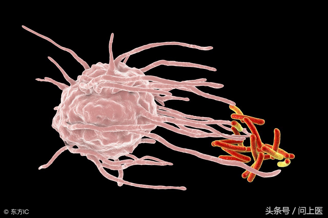 免疫球蛋白a偏高和补体c3偏低,免疫球蛋白检测结果高