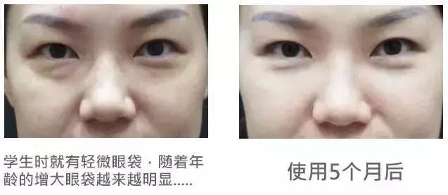 濞滄墡寮犵堪鍒嗘墜鏄湡鏄亣,濞滄墡寮犵堪鍒嗘墜浜嗗悧