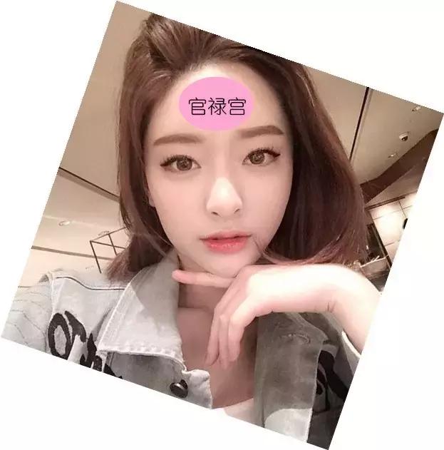 annag鍖荤編濡備綍,annag缇庡