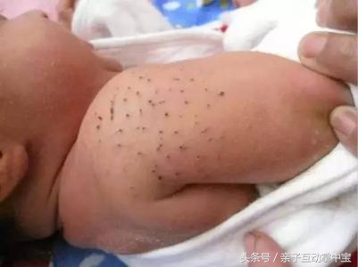 宝宝总是哭闹老人说得了猪毛风,刚出生哭闹声音小