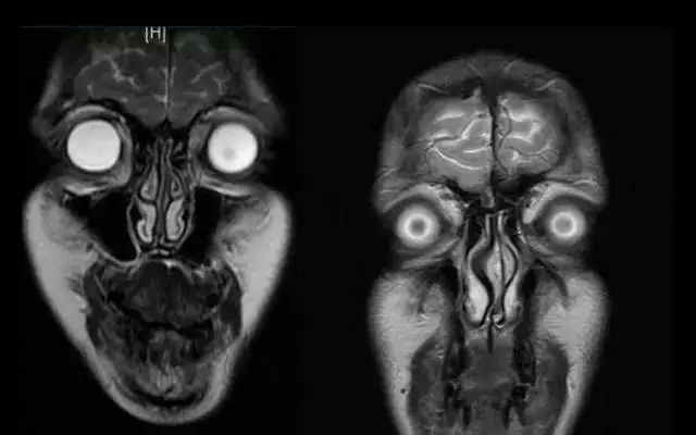目前最先进的磁共振是啥,深圳扫描速度最快的核磁共振