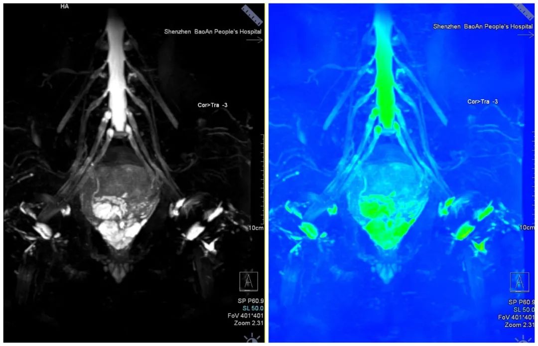 目前最先进的磁共振是啥,深圳扫描速度最快的核磁共振