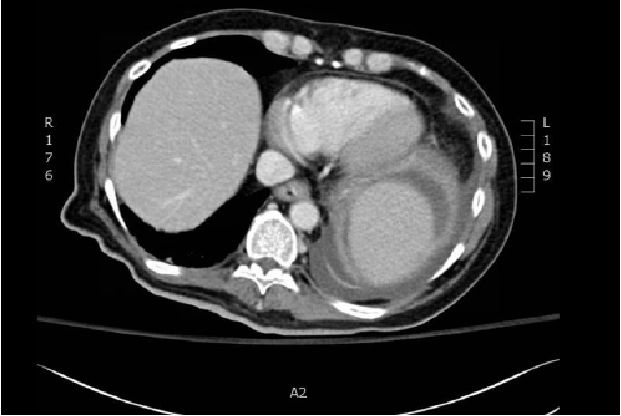 pubmed综述论文,pubmed文献全文
