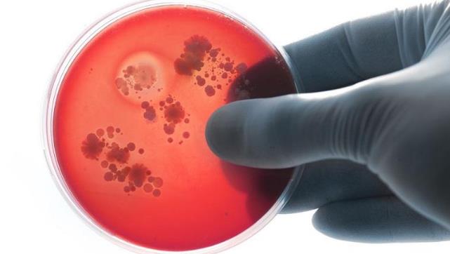 李斯特菌在冷冻中可以存活吗,李斯特菌加热10分钟能杀死吗