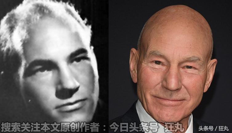 日本研究秃顶,日本教授秃头研究