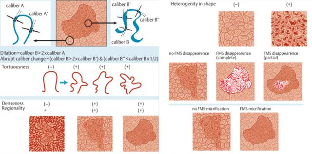 内镜检查痛苦吗,内镜检查是怎么做的