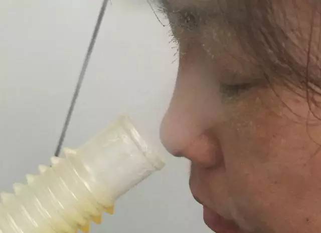 同仁医院能治好鼻炎吗,同仁医院治疗鼻炎开的药