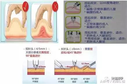 胰岛素注射技术全攻略,打胰岛素笔步骤和方法