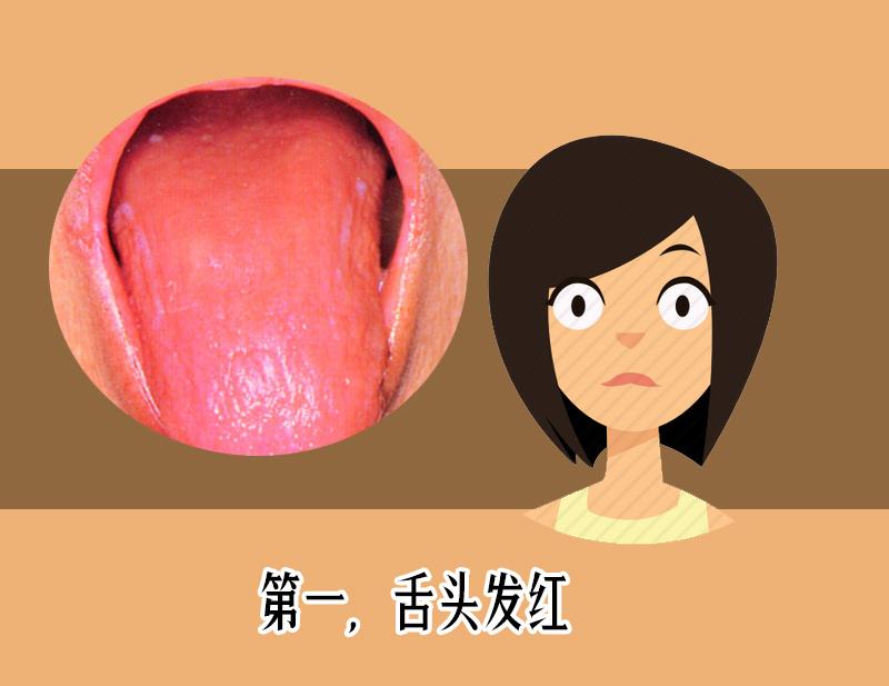 舌头鲜红有舌苔是怎么回事,舌头舌苔很厚变成黑色怎么回事