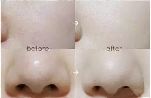 蒂佳婷官网drjart红管bb霜怎么样,drjart蒂佳婷新款bb霜