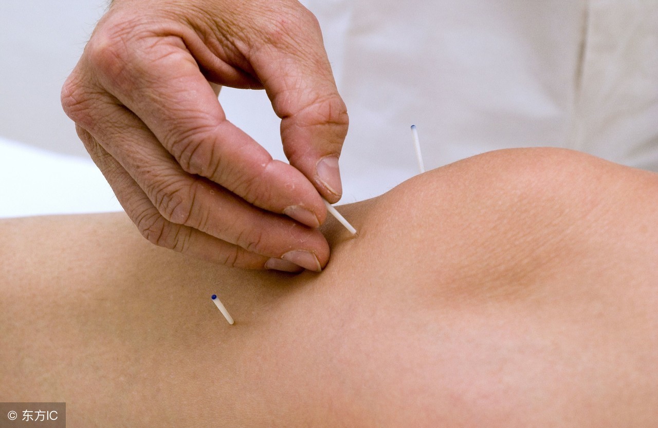 不运动不节食能减大腿吗,减肥不可盲目针灸减肥了解一下