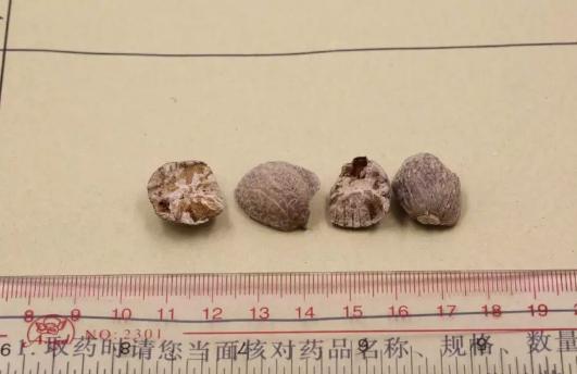 各种豆蔻作用一样吗,砂仁与白豆蔻的功效与作用