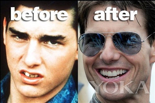 大变脸原来整牙才是高颜值,女星整牙都是越整越美