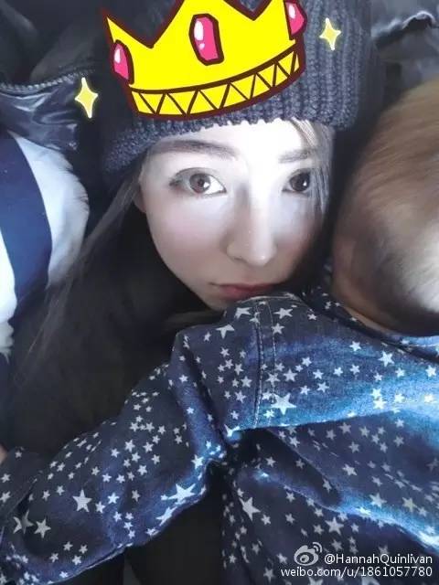 战痘记|杨幂AB不起痘？别逗了，人家只是会祛痘而已！