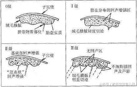 多少周胎盘成熟度到一级,产检单成熟度