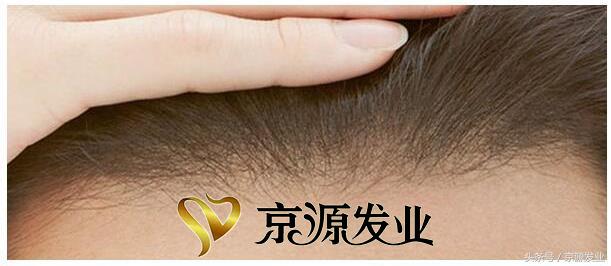 漂发补发根和原来价格一样吗,隐形织发补发是什么