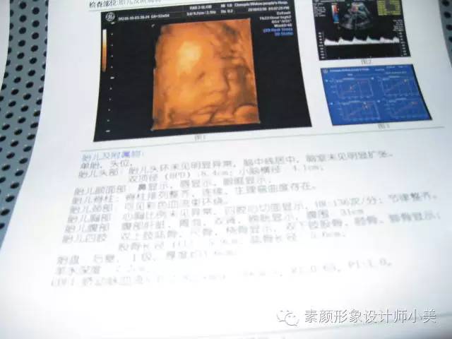 三十二周胎儿发育高清图,孕三十二周胎儿发育完全了吗