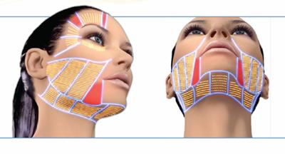 超声刀对抗岁月的神器,超声刀有哪些版本