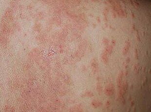 农历五月是毒月,农历五月毒月可信吗