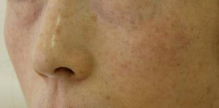 中医祛湿气排毒最快的按摩方法,脸部美容按摩排毒手法