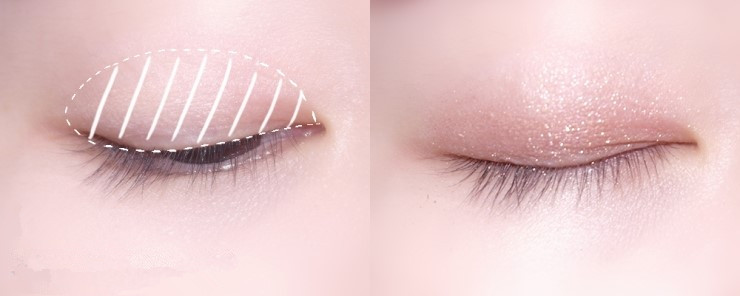 怎么不整容内双变成外双,不用整容缩小鼻头