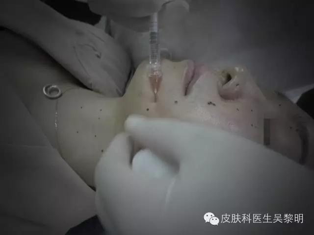 透明质酸护肤品功效,透明质酸是修复皮肤敏感成分