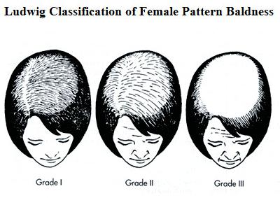 上帝给你留的窗，你开不开
