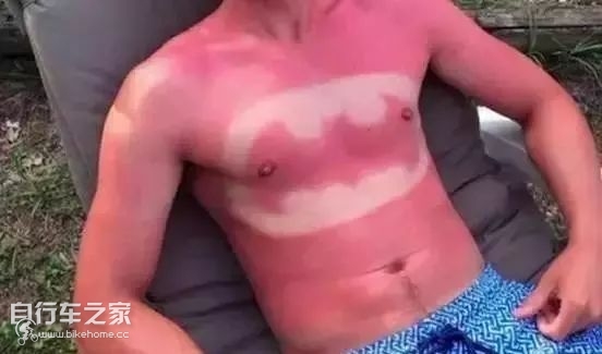 户外骑行常见伤害和应对方法,户外骑行后注意事项