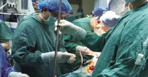 齐鲁医院钢筋贯穿手术,齐鲁医院钢筋