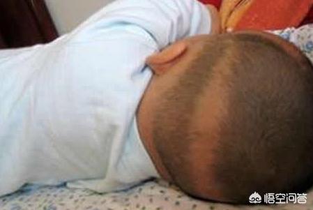 枕秃作为缺钙依据吗,小孩头发少或者枕秃是不是缺钙