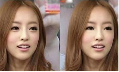 小花科普丨脸上有宝不自知，快来普及下卧蚕的知识！