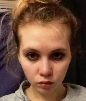 熬夜失眠造成的影响图片,长期失眠人会变丑吗