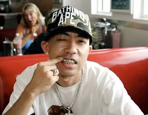 关于最近超火的金牙,你要知道这4件事(起码要知道怎么戴上去吧)