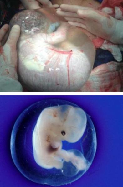 有关羊水的重要性的科普视频,辨别羊水最简单的方法