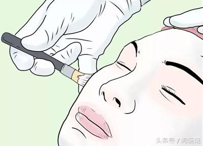 十几年刀疤疤痕修复的最新方法,疤痕修复的最新方法淡疤效果