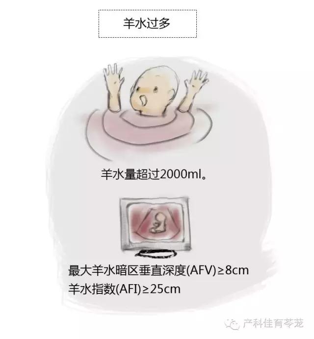 羊水过多和过少的原因,怎么预防羊水过多或过少