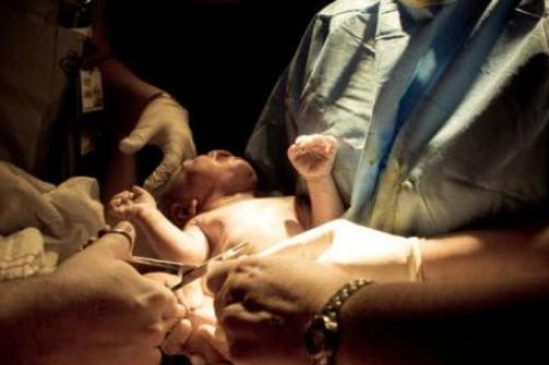 剖腹产女人不可逆的伤害,剖腹产请善待妈妈