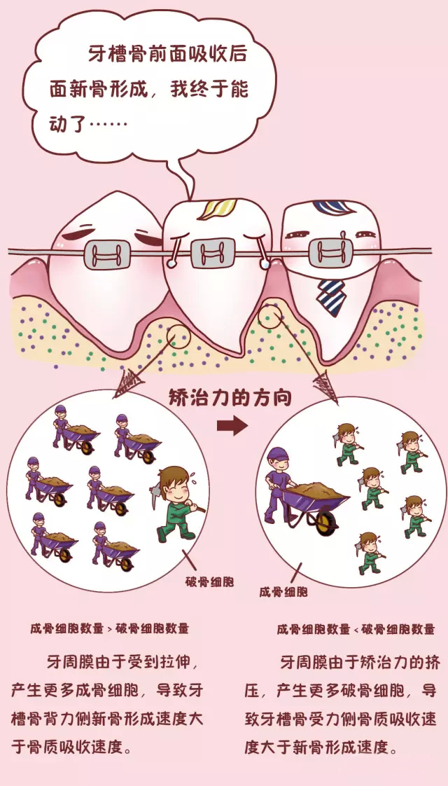 隐形牙套矫正过程中牙齿松动,矫正前几个月牙齿是松动的吗